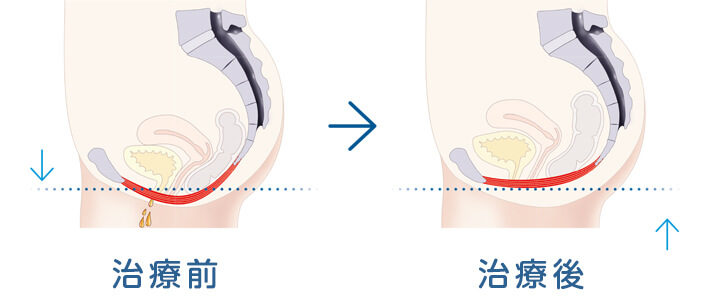 治療内容